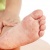 Bệnh tay chân miệng: Lâm sàng, chẩn đoán, biến chứng