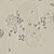 Tế bào Clue cell trong xét nghiệm soi tươi vi khuẩn âm đạo