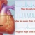 Rối loạn nhịp tim và cách điều trị hiệu quả