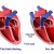 Suy tim - Nguyên nhân và Phương pháp điều trị hiệu quả
