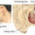 Viêm tai xương chũm cấp tính ở trẻ em - Triệu chứng - Điều trị và phòng bệnh