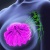 Ung thư vú tái phát có những triệu chứng gì?