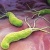 Nhiễm vi khuẩn Helicobacter pylori: Chẩn đoán và điều trị 