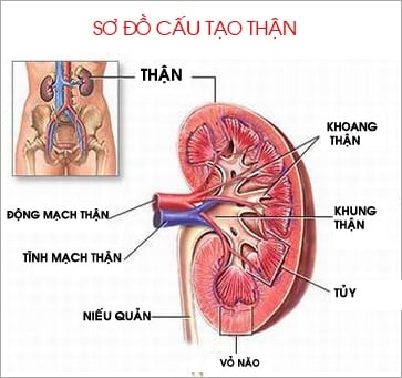 Kidney stone - Ảnh minh họa 2