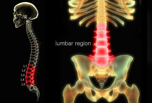 Low back pain - Ảnh minh họa 1