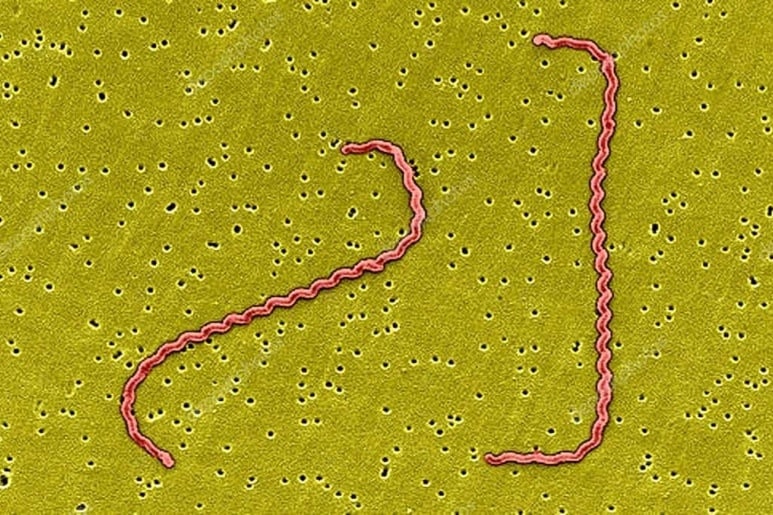 Leptospira - Ảnh minh họa 5