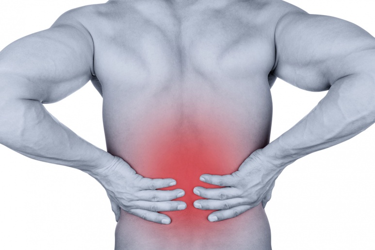 Low back pain - Ảnh minh họa 5