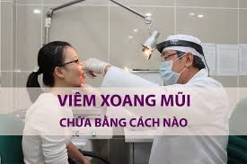 Acute sinusitis - Ảnh minh họa 3