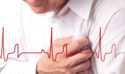 Angina pectoris - Ảnh minh họa 2