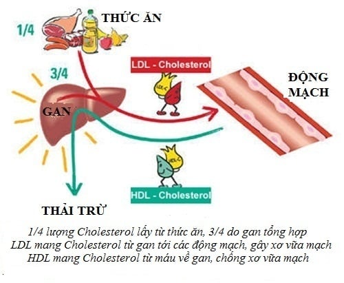 atheroscclerosis - Ảnh minh họa 2