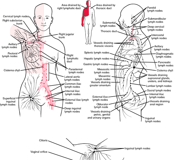 Lymphatic obstruction - Ảnh minh họa 5