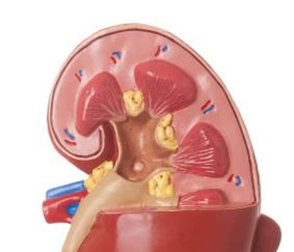 Arteriovenous malformations - Ảnh minh họa 1