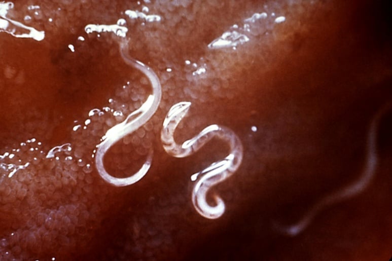 Ancylostoma duodenale - Ảnh minh họa 3