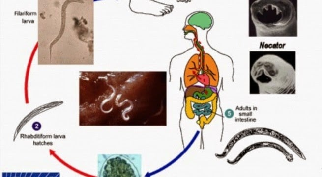 Ancylostoma duodenale - Ảnh minh họa 1