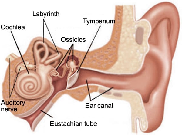 Labyrinthitis - Ảnh minh họa 2