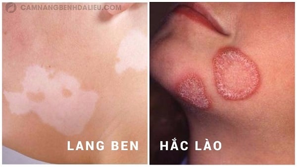 Lang ben - Ảnh minh họa 5