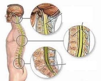 Acute Spinal Cord Injury - Ảnh minh họa 2