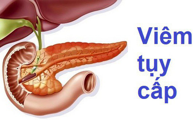 Acute pancreatitis - Ảnh minh họa 4