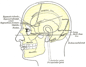 Mastoiditis - Ảnh minh họa 1