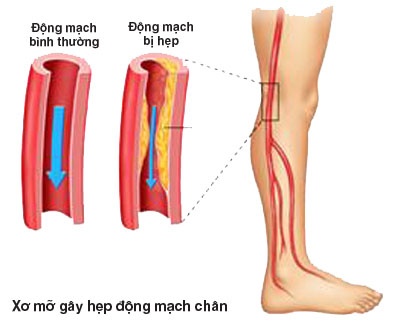 Mạch máu ngoại biên - Ảnh minh họa 3