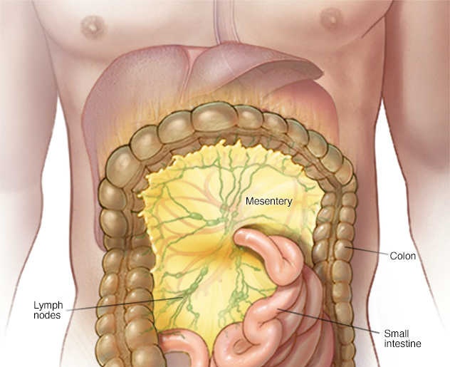 Mesenteric Lymphadenitis - Ảnh minh họa 3