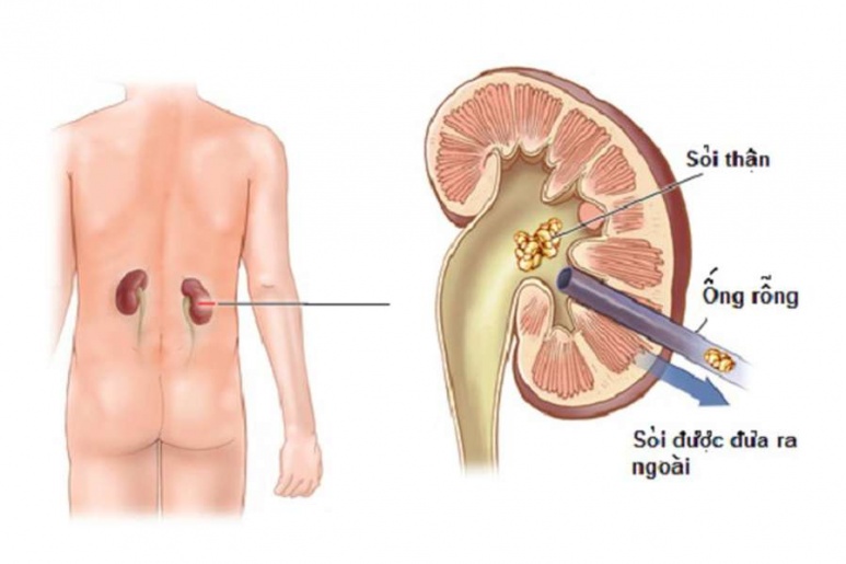 Arterial Embolism and Thrombosis - Ảnh minh họa 3