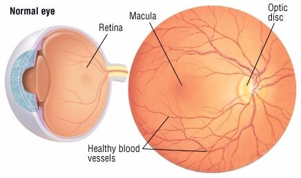 Mạch máu võng mạc - Ảnh minh họa 4