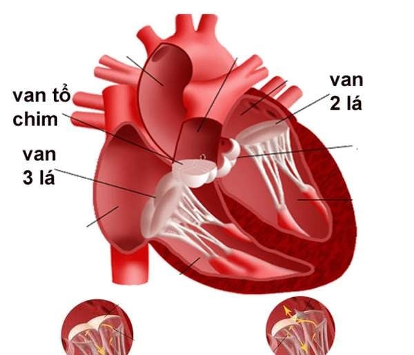 Aortic Valvular Regurgitation - Ảnh minh họa 1