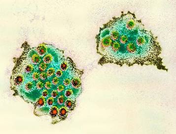 Nhiễm Norovirus - Ảnh minh họa 1