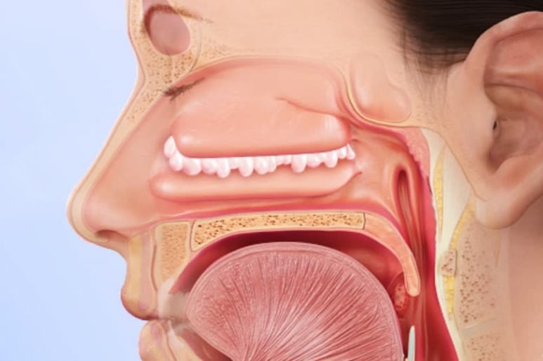 Nasal polyps - Ảnh minh họa 1