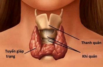 Nhược giáp trạng - Ảnh minh họa 1