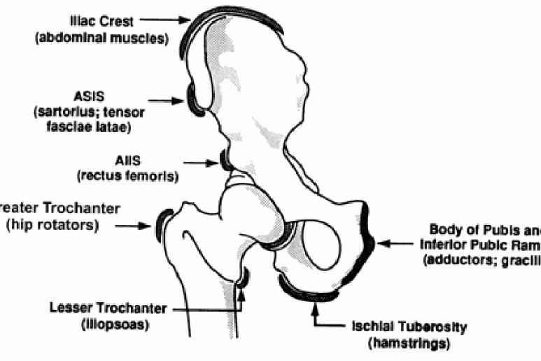 Avulsion Injuries - Ảnh minh họa 2