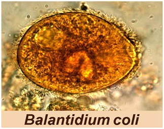 Nhiễm trùng lông Balantidium - Ảnh minh họa 3