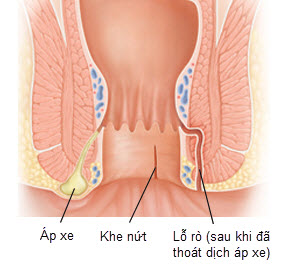 Ngứa hậu môn - Ảnh minh họa 3