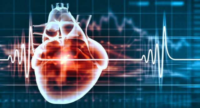 Arrhythmia Palpitations - Ảnh minh họa 3