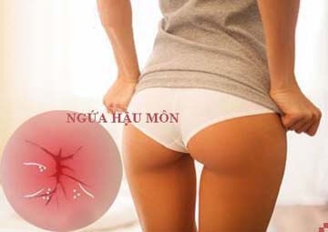 Ngứa hậu môn - Ảnh minh họa 5