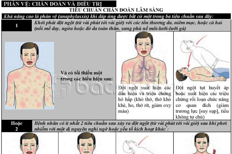 Anaphylaxis - Ảnh minh họa 3