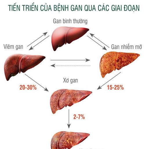 Acute Hepatitis - Ảnh minh họa 1