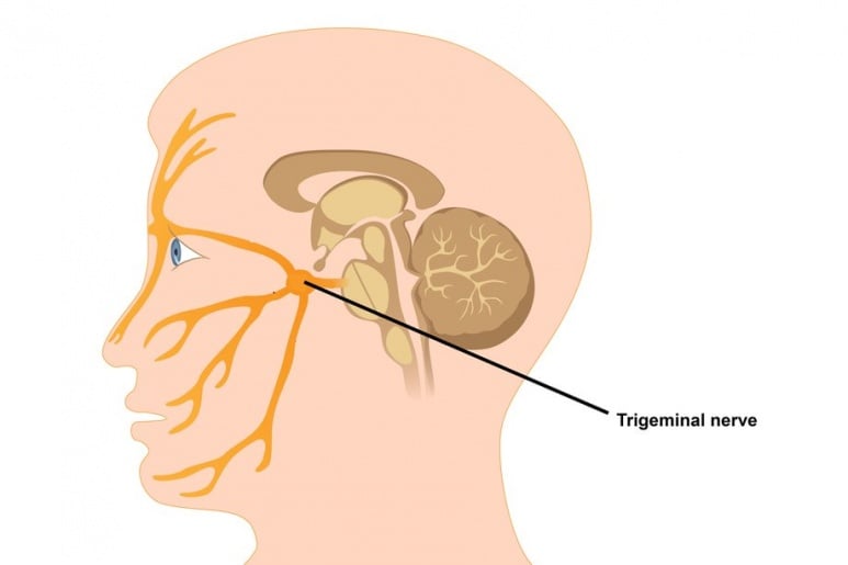 Neuralgia - Ảnh minh họa 1