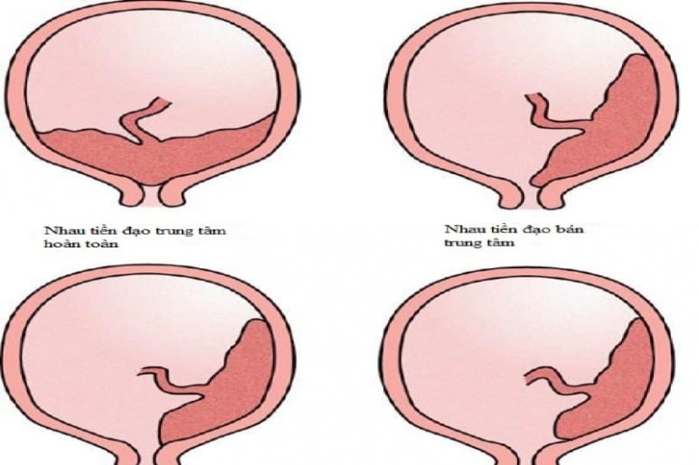 Nhau tiền đạo - Ảnh minh họa 4