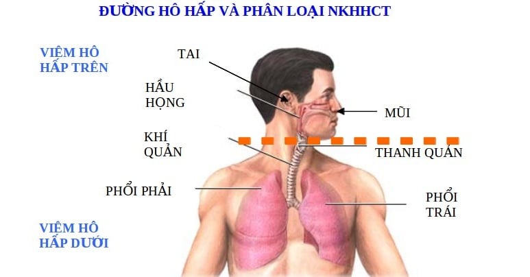 Nhiễm khuẩn cấp tính - Ảnh minh họa 4