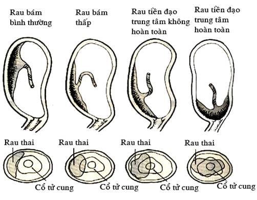 Nhau tiền đạo - Ảnh minh họa 5