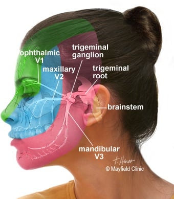 Neuralgia - Ảnh minh họa 3