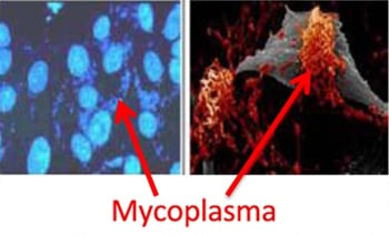 Nhiễm khuẩn Mycoplasma - Ảnh minh họa 2