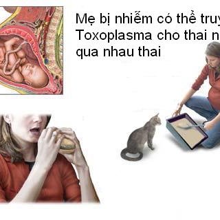 Nhiễm Toxoplasma - Ảnh minh họa 3