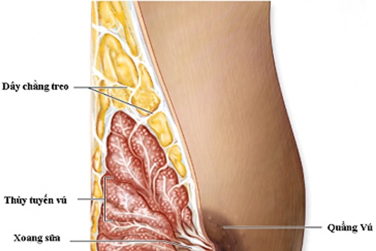 Breast cancer - Ảnh minh họa 3