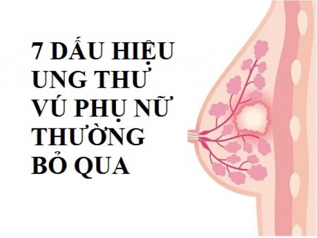 Breast cancer - Ảnh minh họa 2