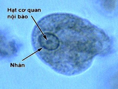 Nhiễm khuẩn Entamoeba Histolytica - Ảnh minh họa 2