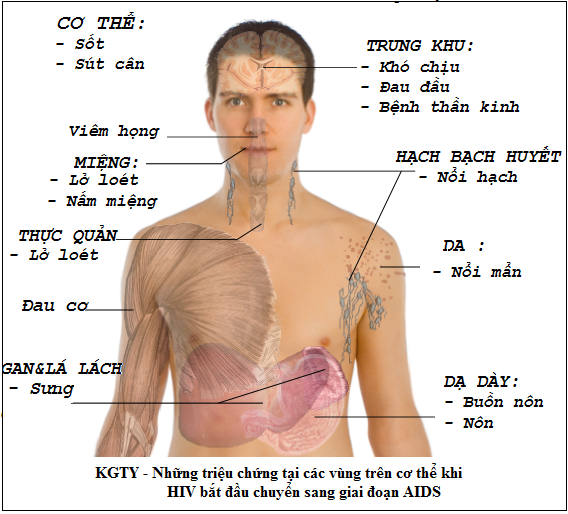 Nhiễm trùng cơ - Ảnh minh họa 1