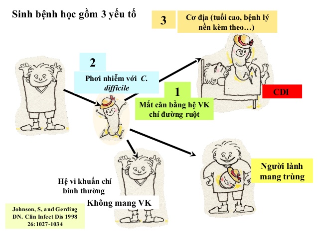 Nhiễm vi khuẩn Clostridium difficile (C. Diff) - Ảnh minh họa 2